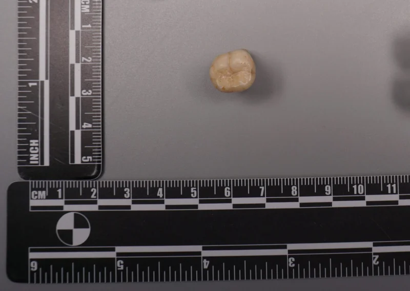 Antik proteinler, Denisovan soyunda Homo erectus izine işaret ediyor