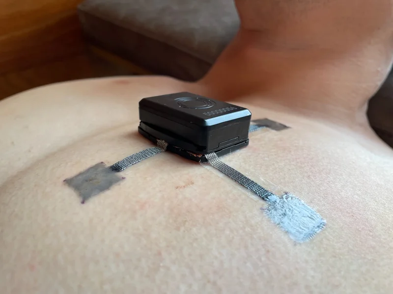 A WE-PPD electrode taped to a man's chest